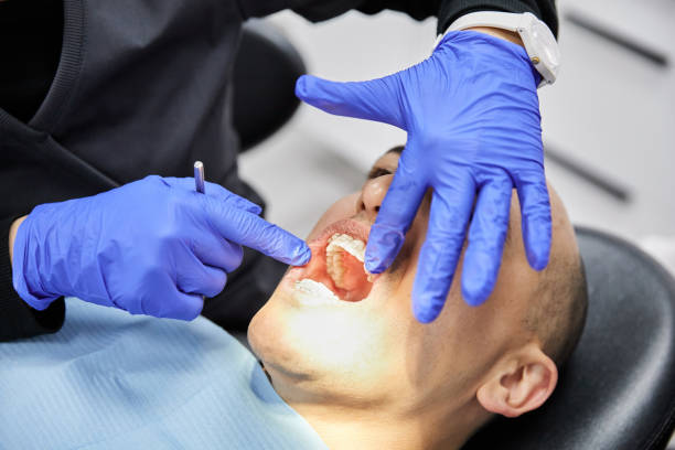 Best Emergency Broken Tooth Repair in Carrizo Springs, TX